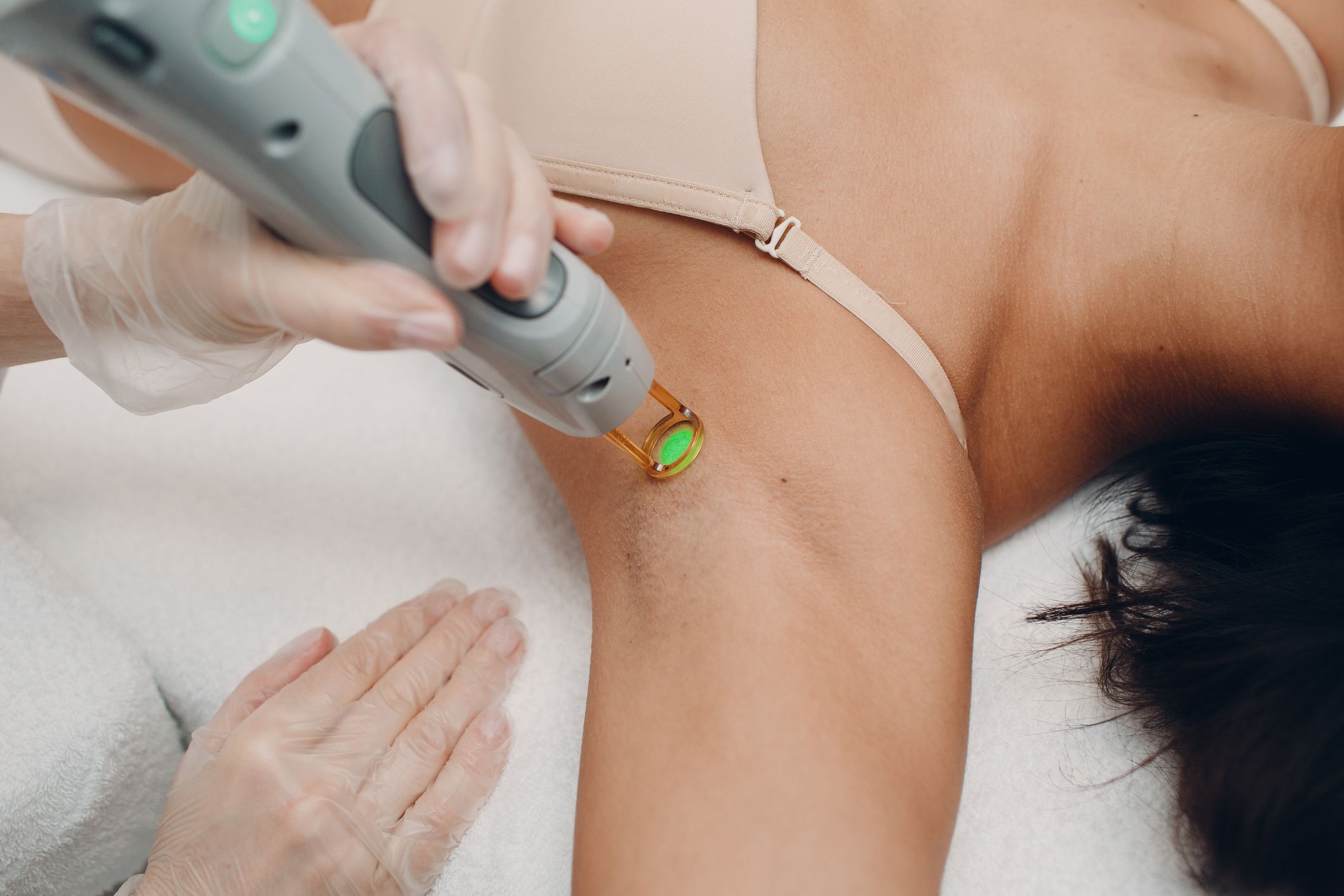 Flawless Skin Awaits: Derby's Laser Hair Removal Experts